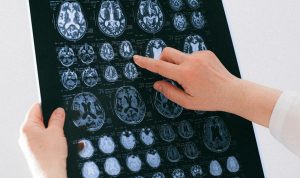 Attachment for 5 Fakta Menarik Tentang Otak yang Buktikan Kemampuannya Berkembang Seumur Hidup